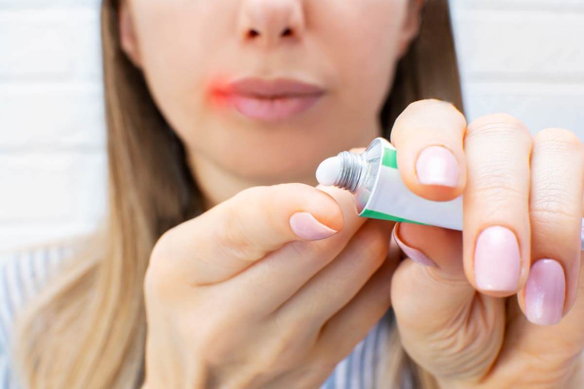 唇皰疹藥膏作用